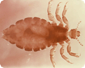 Adult head louse.