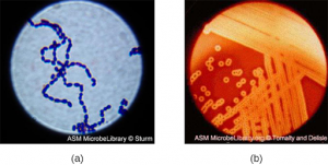 "OSC Microbio 04 04 Strep.jpg" by CNX OpenStax is licensed under CC BY 4.0 Access for free at https://openstax.org/books/microbiology/pages/4-4-gram-positive-bacteria Photos of Gram Stain Specimins