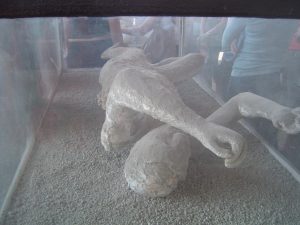 The body is outlined with a cast, and the bones are seen.