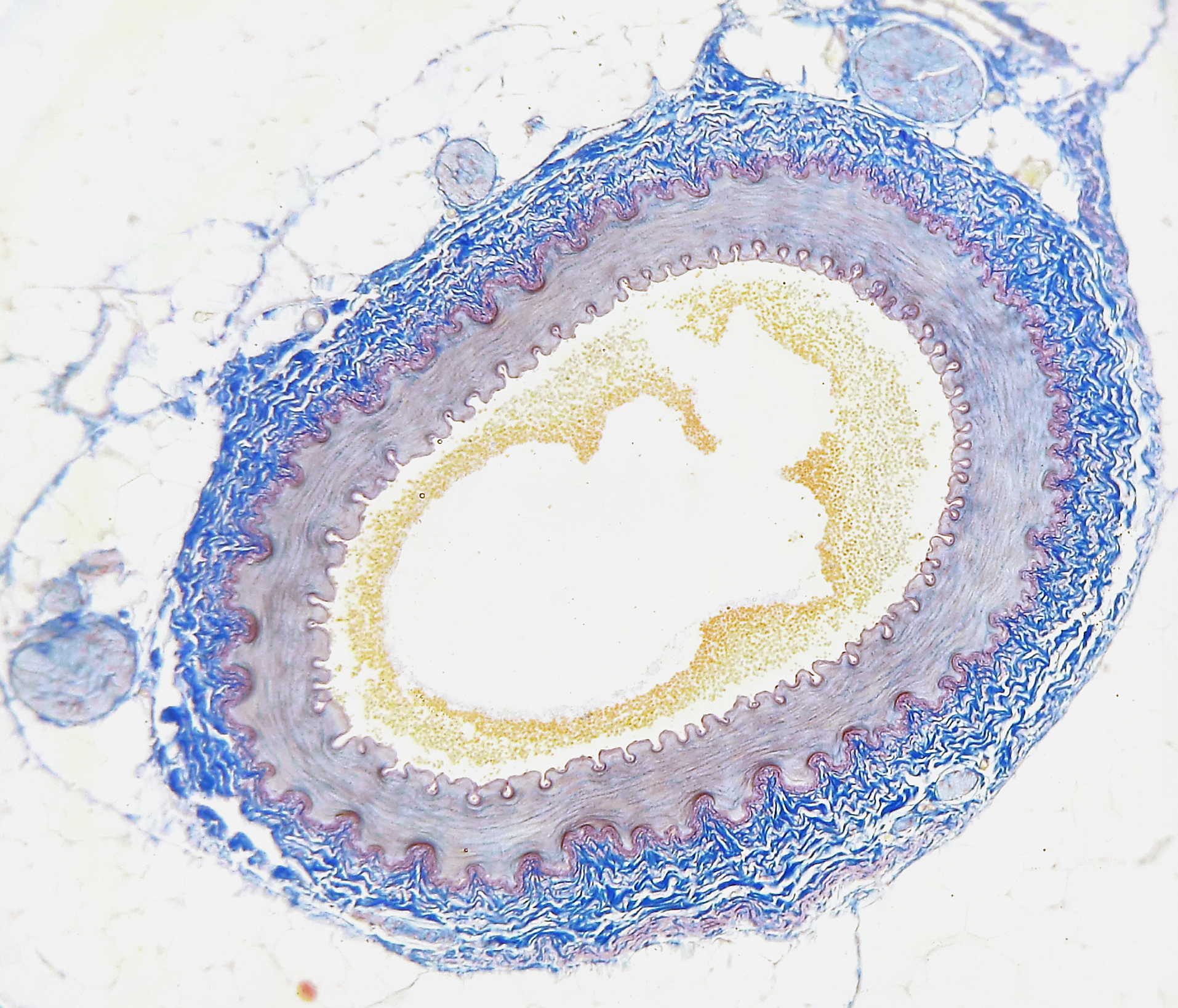 14.4.8 Artery Cross Section