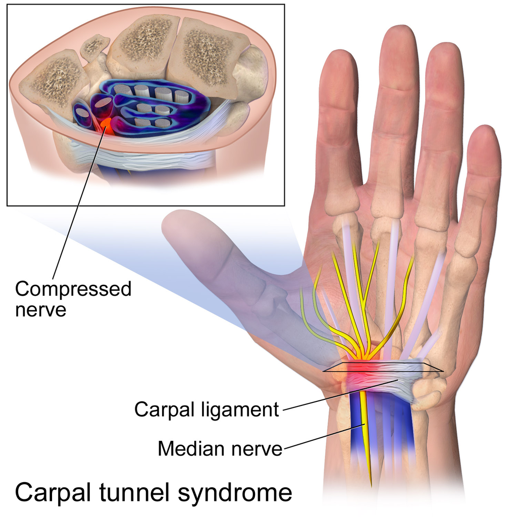 12.6 Carpal Tunnel