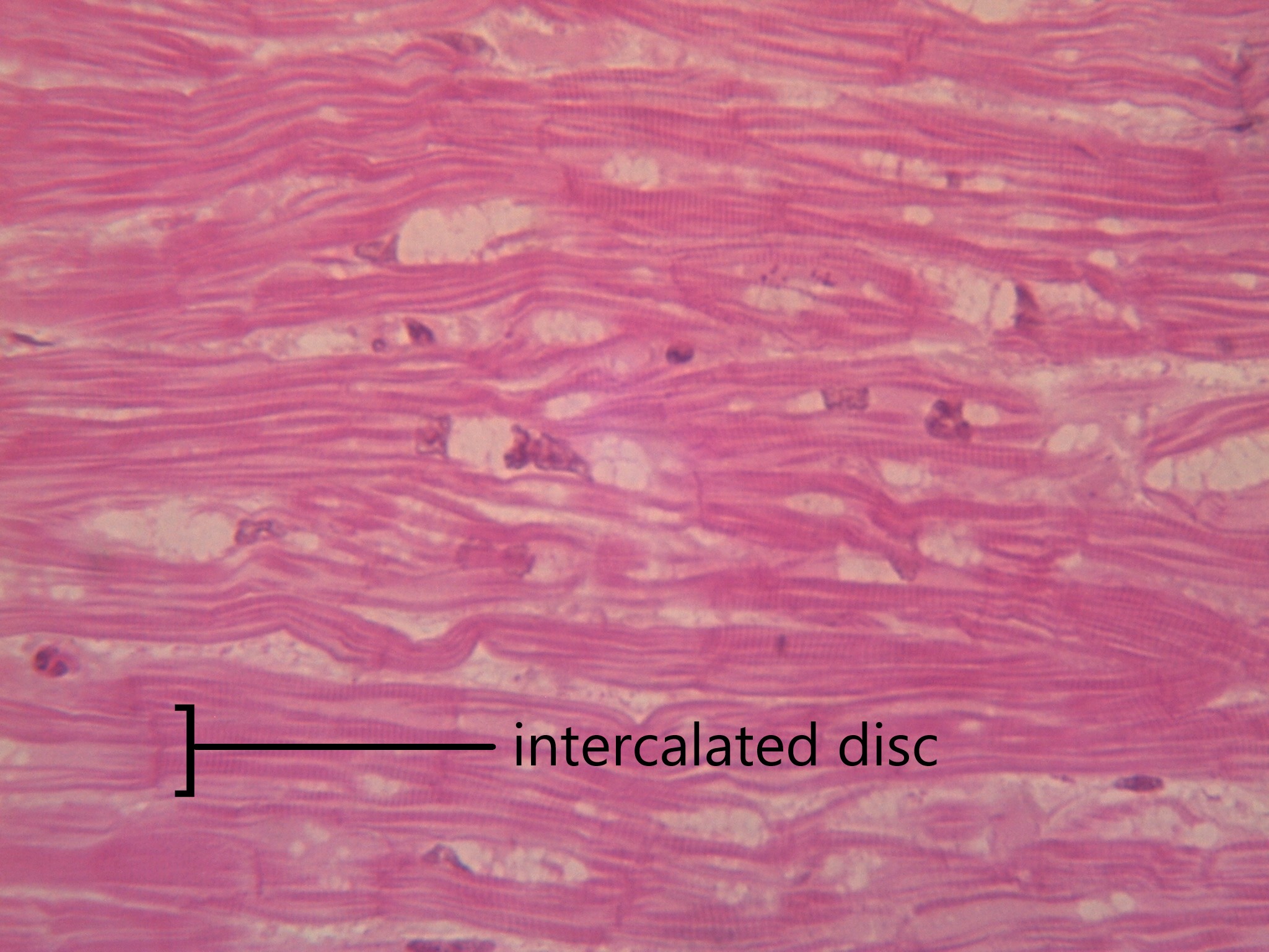 Cardiac Muscle