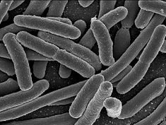 17.2a E. Coli