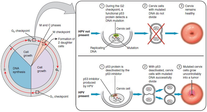 18.9.3 HPV and Cervical Cancer