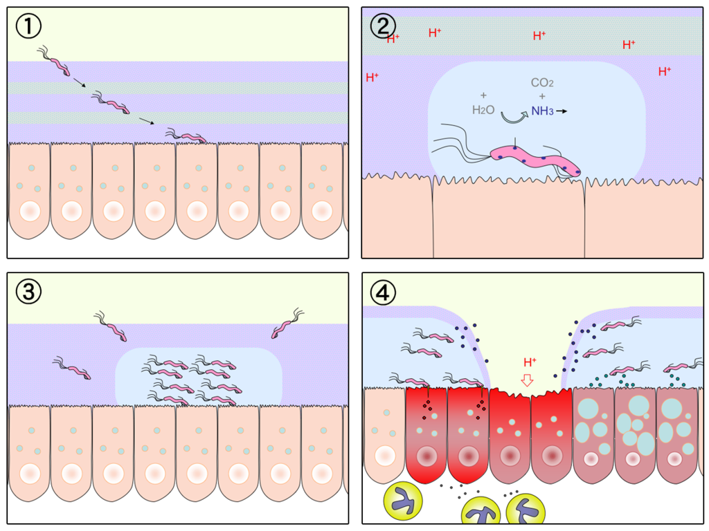 15.7.4 H.Pylori and Peptic Ulcer