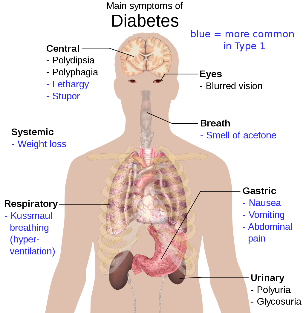 Symptoms of Diabetes