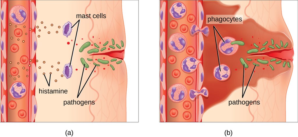 17.4.4 Inflammatory Response