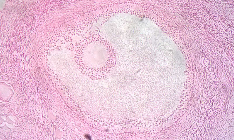 18.6.4 Ovarian Follicle