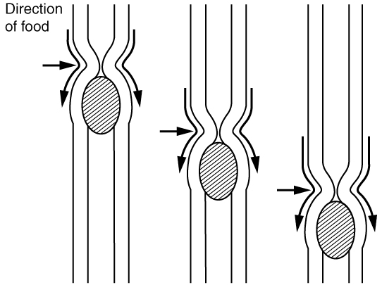 Peristalsis