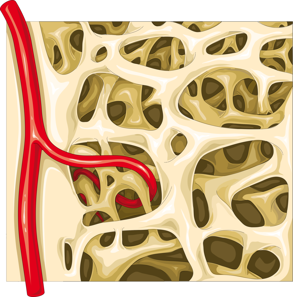 11.4.5 Spongy Bone Diagram