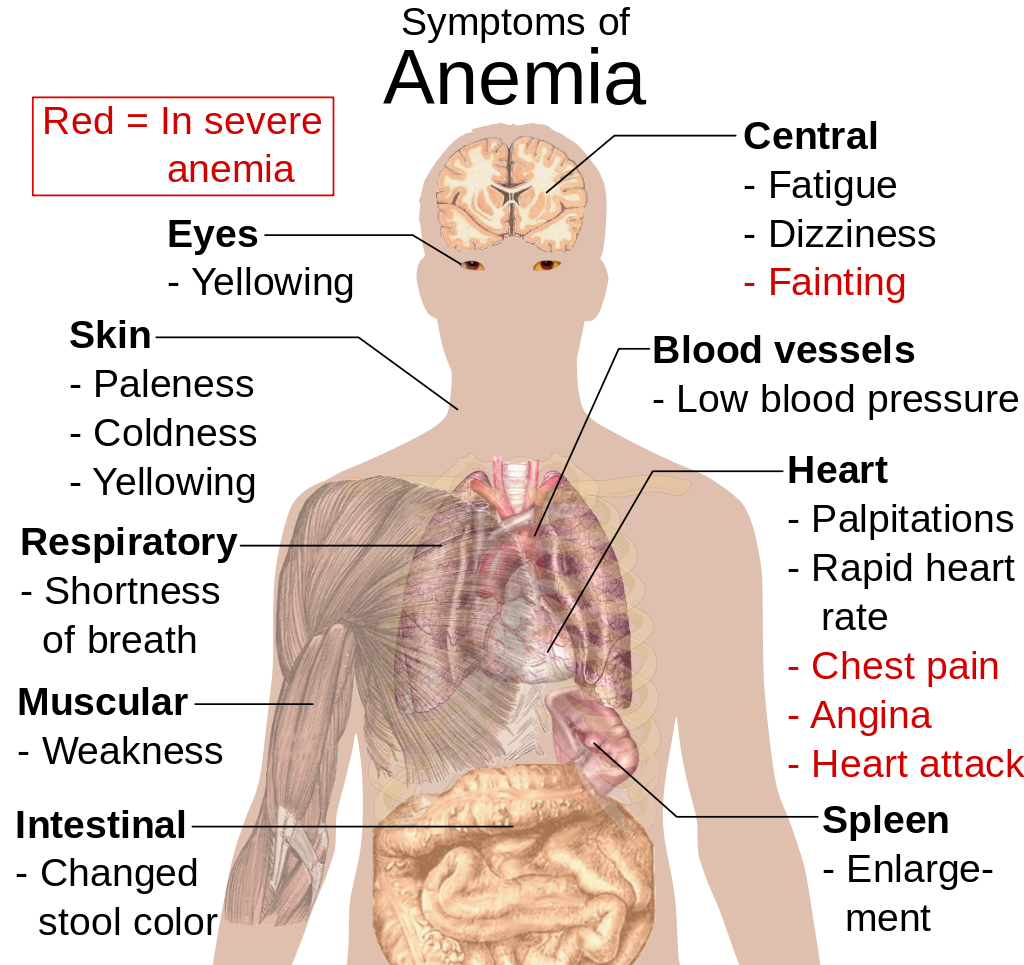 14.5.7 Symptoms of Anemia