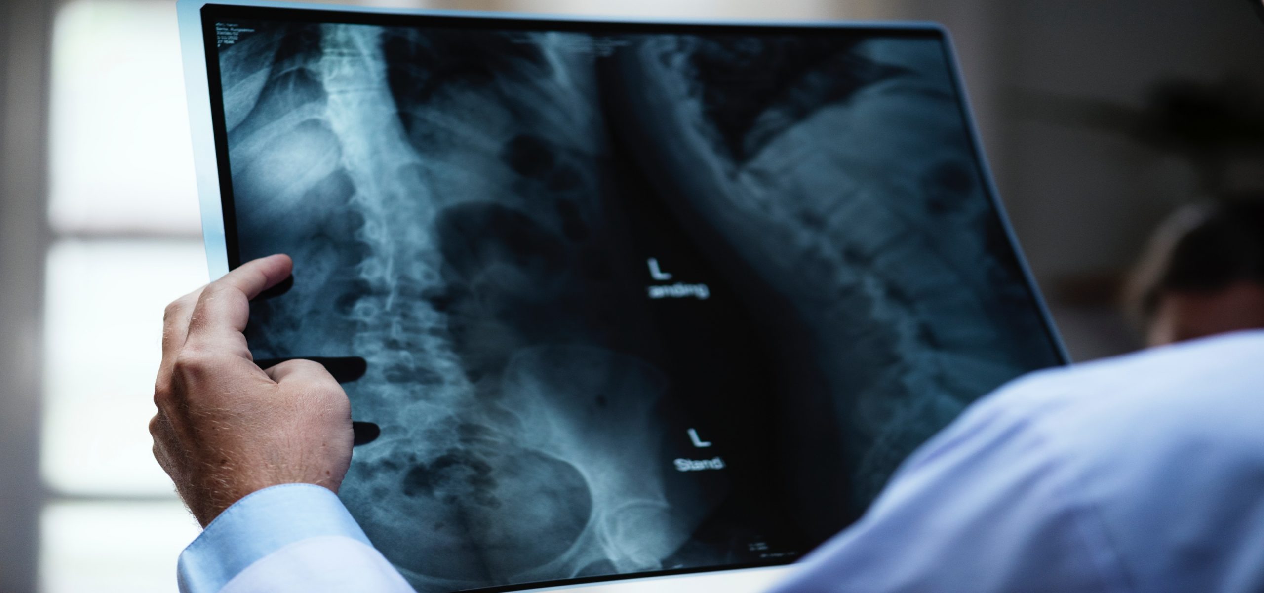 A health professional viewing an xray.