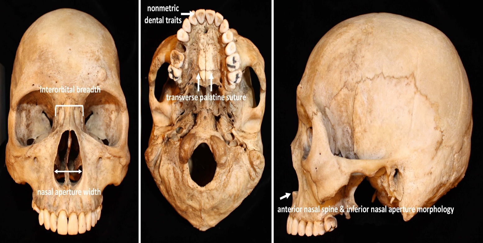 Skeletal traits commonly used in a morphological assessment of ancestry.