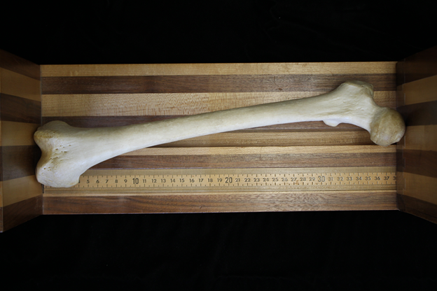 Image of measurement of the bicondylar length of the femur, often used in the estimation of living stature.