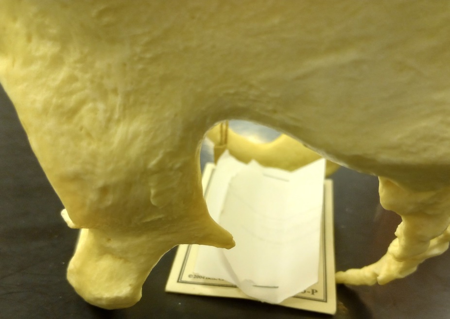 An image a wide greater sciatic bone found in a female pelvis.