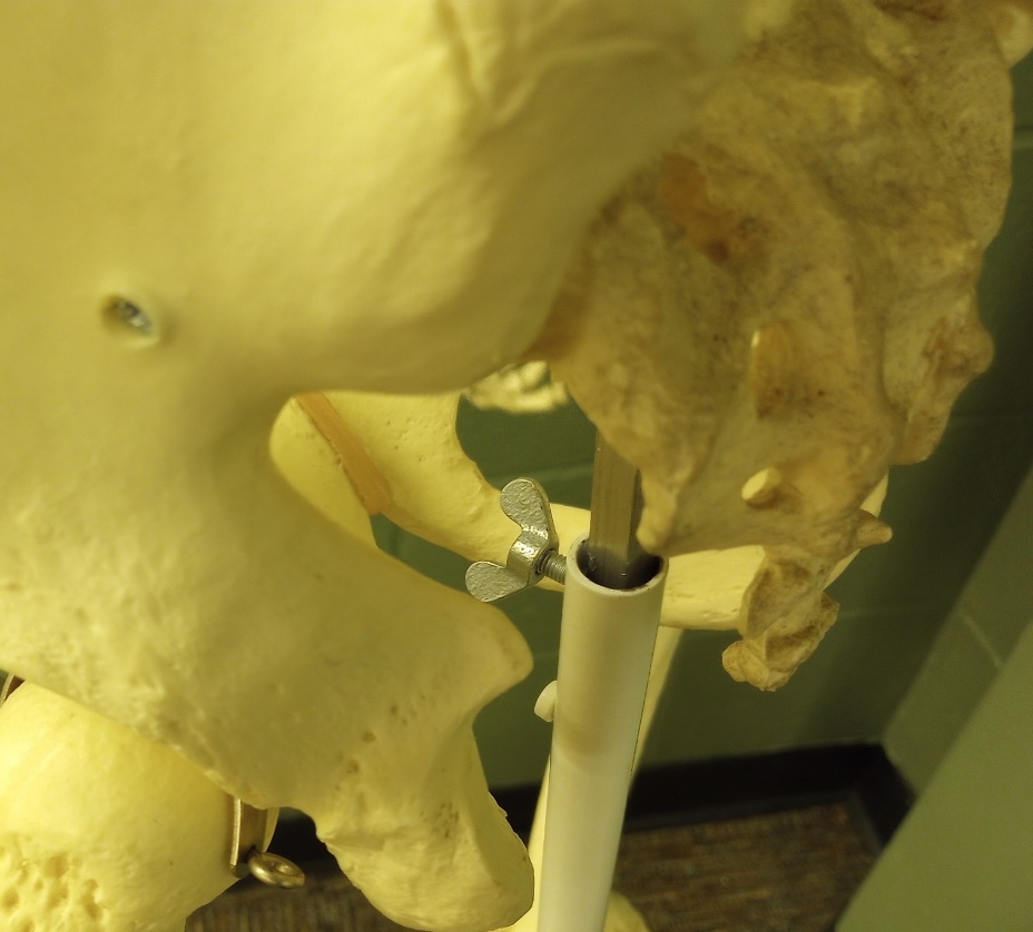 An image of a narrow greater sciatic bone found in a male pelvis.