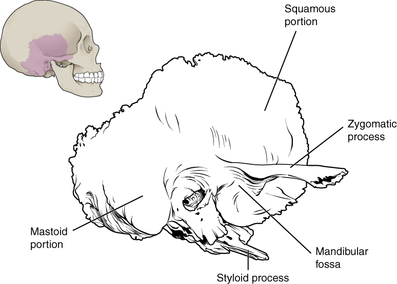 A lateral view of the isolated temporal bone shows the squamous portion.