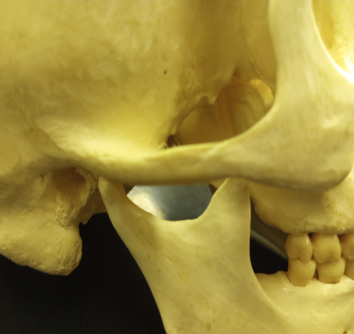 Image showing the wide zygomatic arch found in males.