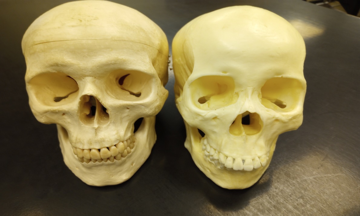 The skull on the left is male and more robust. The skull on the right is female and more gracile.