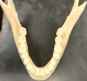 Lower dentition of an adult. All permanent teeth have erupted.