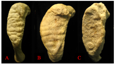 Examples of degenerative changes to the pubic symphysis: (A) young adult; (B) middle adult; (C) old adult.