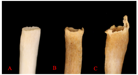 Examples of degenerative changes to the sternal rib end: (A) young adult; (B) middle adult; (C) old adult.