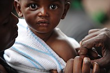 Infant being administered a measles vaccine in Kibati, Congo.