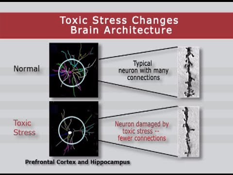 Normal - Typical neuron with many connections. Toxic Stress - Neuron damaged by toxic stress has fewer connections.