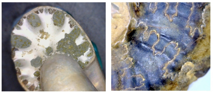 The septum of an ammonite (white part, left), and the suture lines where the septae meet the outer shell (right).